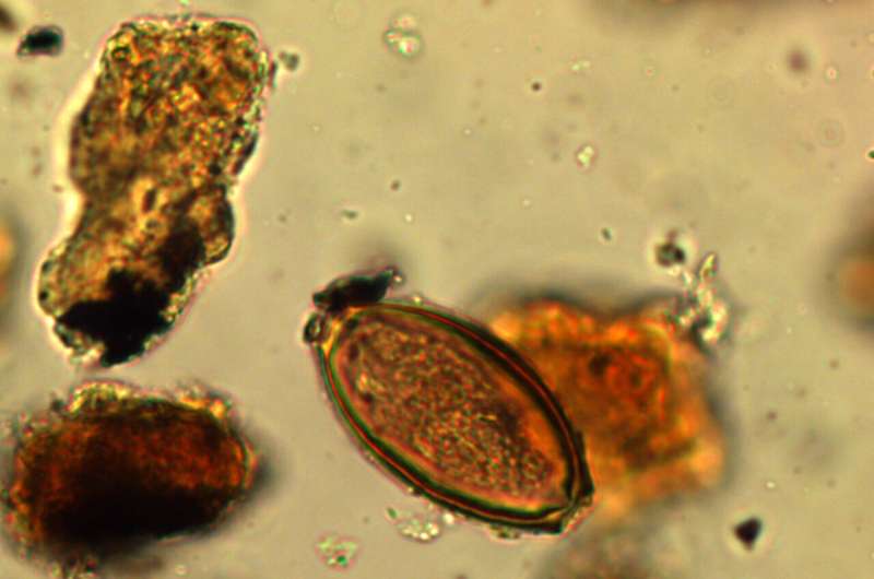 Parasitical infection of soldiers at Hadrian’s&nbsp;Wall